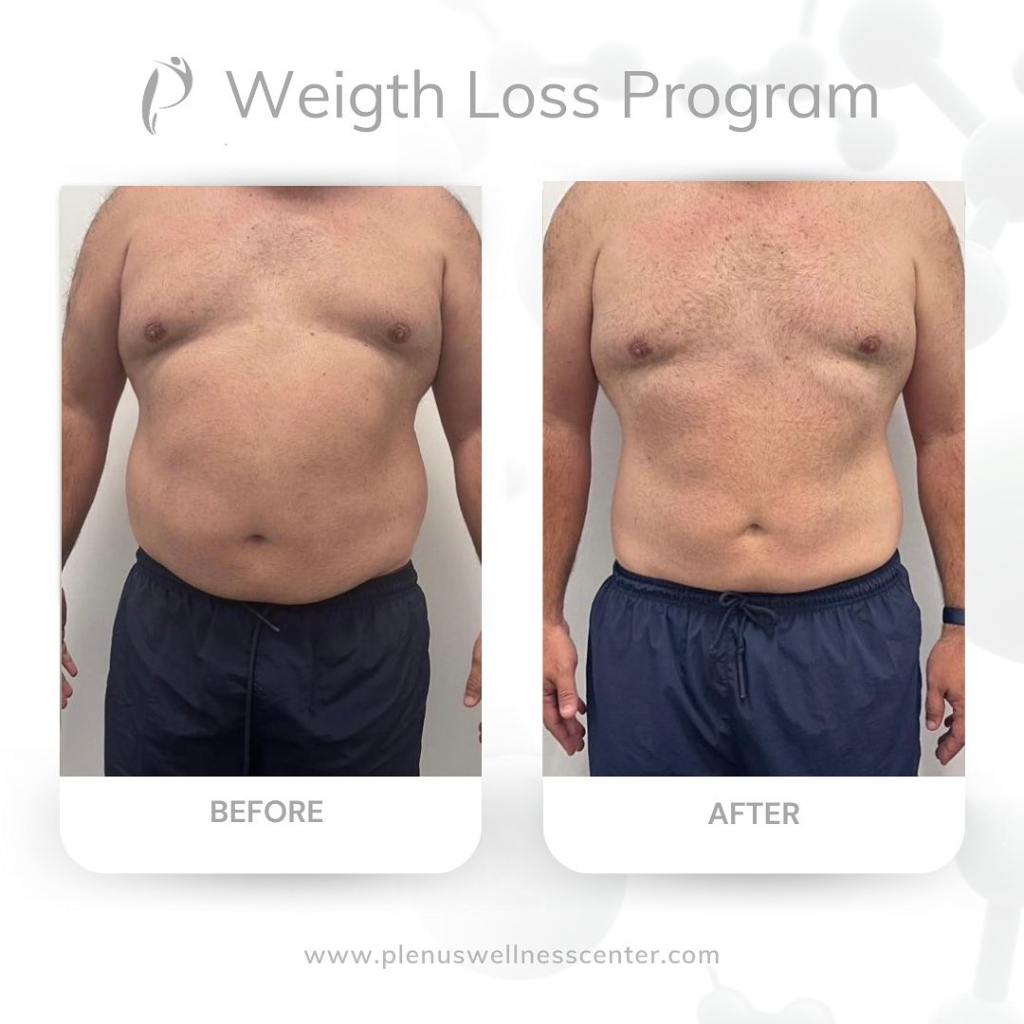 weight-loss-marietta11